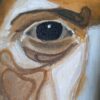 Abismo intraocular - Imagen 2